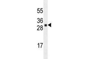 UBTD1 antibody western blot analysis in A549 lysate. (UBTD1 anticorps)