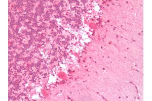 Human Brain, Cerebellum: Formalin-Fixed, Paraffin-Embedded (FFPE) (Serotonin Receptor 6 anticorps  (C-Term))