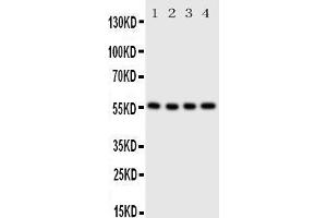 Anti-Glucose Transporter 5 GLUT5 antibody, Western blotting Lane 1: U87 Cell Lysate Lane 2: 293T Cell Lysate Lane 3:  Cell Lysate Lane 4: SW620 Cell Lysate (SLC2A5 anticorps  (C-Term))