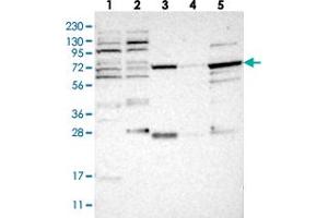Western blot analysis of Lane 1: RT-4, Lane 2: U-251 MG, Lane 3: Human Plasma, Lane 4: Liver, Lane 5: Tonsil with NUDCD1 polyclonal antibody  at 1:250-1:500 dilution.