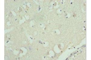 Immunohistochemistry of paraffin-embedded human brain tissue using ABIN7142845 at dilution of 1:100