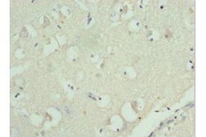 Immunohistochemistry of paraffin-embedded human brain tissue using ABIN7142845 at dilution of 1:100 (RPL9 anticorps  (AA 1-192))