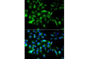 Immunofluorescence analysis of HeLa cell using MYD88 antibody. (MYD88 anticorps  (AA 60-309))