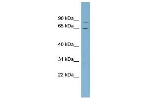 WB Suggested Anti-RPA1  Antibody Titration: 0. (RPA1 anticorps  (Middle Region))