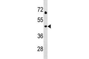 LAMP3 antibody western blot analysis in Jurkat lysate. (LAMP3 anticorps  (AA 8-38))