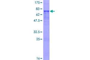 Image no. 1 for Inositol Polyphosphate-5-Phosphatase K (INPP5K) (AA 1-448) protein (GST tag) (ABIN1307963)