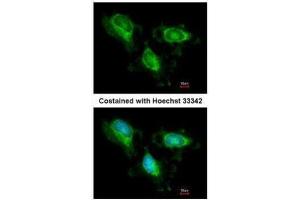 ICC/IF Image Immunofluorescence analysis of methanol-fixed HeLa, using Fumarate hydratase, antibody at 1:200 dilution. (FH anticorps)