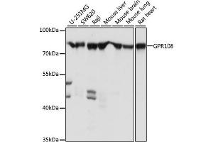 Western blot analysis of extracts of various cell lines, using GPR108 antibody (ABIN7267291) at 1:1000 dilution. (GPR108 anticorps  (AA 33-260))