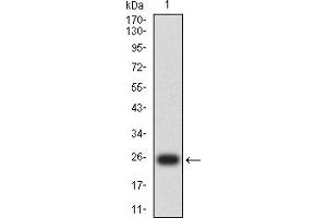 Western blot analysis using MLH1 mAb against human MLH1 (AA: 381-483) recombinant protein. (MLH1 anticorps  (AA 381-483))