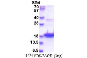 SDS-PAGE (SDS) image for Defensin, beta 118 (DEFB118) (AA 21-123) protein (His tag) (ABIN5853404) (DEFB118 Protein (AA 21-123) (His tag))