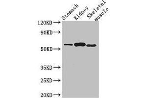 Western Blot Positive WB detected in: Mouse stomach tissue, Mouse kidney tissue, Mouse skeletal muscle tissue All lanes: PPM1H antibody at 3. (PPM1H anticorps  (AA 73-289))