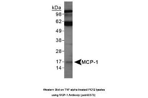 Image no. 1 for anti-Chemokine (C-C Motif) Ligand 2 (CCL2) (AA 15-40) antibody (ABIN363682) (CCL2 anticorps  (AA 15-40))
