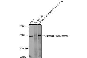 Immunoprecipitation analysis of 300 μg extracts of U-251MG cells using 3 μg Glucocorticoid Receptor antibody (ABIN7269016).