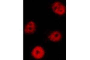 ABIN6269187 staining Hela by IF/ICC. (EIF2AK2 anticorps  (Internal Region))