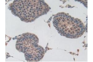 Detection of Plg in Rat Testis Tissue using Polyclonal Antibody to Plasminogen (Plg) (PLG anticorps  (AA 191-433))