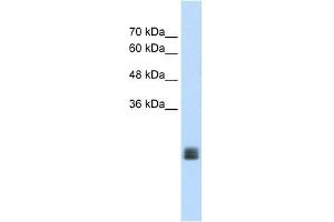 MGC33926 antibody used at 1. (TMEM178 anticorps  (Middle Region))