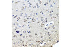 Immunohistochemistry of paraffin-embedded mouse brain using CHRNB2 antibody at dilution of 1:100 (x40 lens).