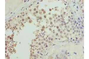 Immunohistochemistry of paraffin-embedded human testis tissue using ABIN7149078 at dilution of 1:100