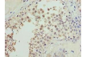 Immunohistochemistry of paraffin-embedded human testis tissue using ABIN7149078 at dilution of 1:100 (CDADC1 anticorps  (AA 1-99))