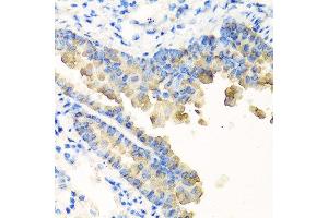 Immunohistochemistry of paraffin-embedded mouse lung using NYX antibody at dilution of 1:100 (40x lens). (Nyctalopin anticorps)