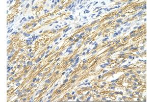 Rabbit Anti-MBNL1 Antibody       Paraffin Embedded Tissue:  Human cardiac cell   Cellular Data:  Epithelial cells of renal tubule  Antibody Concentration:   4. (MBNL1 anticorps  (Middle Region))
