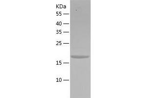 Western Blotting (WB) image for NTF2-Related Export Protein 1 (NXT1) (AA 1-160) protein (His tag) (ABIN7124198)