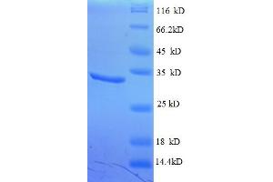 SDS-PAGE (SDS) image for Chromodomain Helicase DNA Binding Protein 4 (CHD4) (AA 1-219), (partial) protein (His tag) (ABIN5712109) (CHD4 Protein (AA 1-219, partial) (His tag))