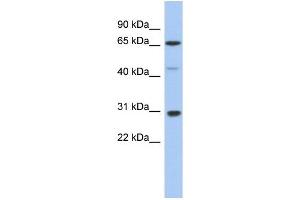 WB Suggested Anti-PIAS3 Antibody Titration:  0.
