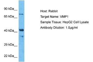 Host:  Rabbit  Target Name:  VMP1  Sample Type:  HepG2 Whole Cell lysates  Antibody Dilution:  1. (VMP1 anticorps  (Middle Region))