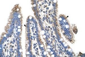 Image no. 1 for anti-Solute Carrier Family 25, Member 39 (SLC25A39) (C-Term) antibody (ABIN6736659) (SLC25A39 anticorps  (C-Term))