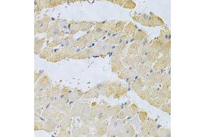 Immunohistochemistry of paraffin-embedded rat heart using PPA1 Antibody.