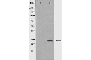 Western blot analysis of 293T  lysate using EDN1 antibody.
