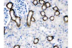 anti-Calcium-Sensing Receptor (CASR) (AA 926-1078) antibody