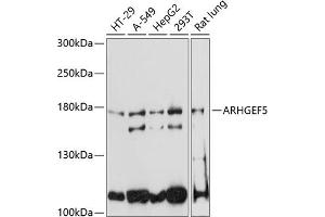Western blot analysis of extracts of various cell lines, using  antibody (ABIN6129195, ABIN6137096, ABIN6137097 and ABIN6220538) at 1:3000 dilution. (ARHGEF5 anticorps  (AA 1248-1597))