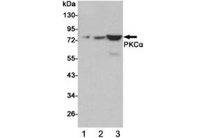 Western blot testing of 1) human C2C12, 2) monkey COS7 and 3) rat C6 cell lysates using PKC alpha antibody at 1:1000. (PKC alpha anticorps)