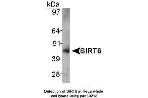 Image no. 1 for anti-Sirtuin 6 (SIRT6) (AA 250-350), (Internal Region) antibody (ABIN363527) (SIRT6 anticorps  (Internal Region))
