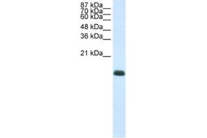 Western Blotting (WB) image for anti-Zinc Finger Protein 786 (ZNF786) antibody (ABIN2461987) (ZNF786 anticorps)
