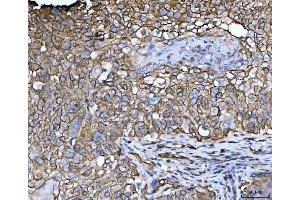 IHC analysis of EPLIN/LIMA1 using anti-EPLIN/LIMA1 antibody (ABIN7602639).