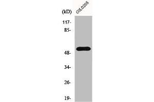 Western Blot analysis of COLO205 cells using HisRS Polyclonal Antibody (HARS1/Jo-1 anticorps  (C-Term))