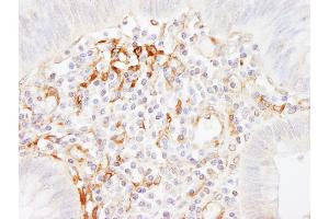 Immunohistochemistry (IHC) image for anti-Filamin A, alpha (FLNA) (AA 400-450) antibody (ABIN7454529)