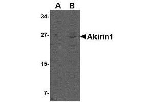 Western blot analysis of Akirin1 in rat liver lysate with AP30039PU-N Akirin1 antibody at (A) 1 and (B) 2 μg/ml. (Akirin 1 anticorps  (Center))
