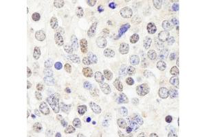 Immunohistochemistry (IHC) image for anti-Histone Deacetylase 7 (HDAC7) (AA 902-952) antibody (ABIN7448594) (HDAC7 anticorps  (AA 902-952))