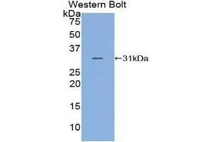 Detection of Recombinant C2, Human using Polyclonal Antibody to Complement Component 2 (C2) (Complement C2 anticorps  (AA 245-451))