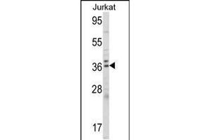 Western blot analysis of ALAD Antibody (C-term) (ABIN390809 and ABIN2841046) in Jurkat cell line lysates (35 μg/lane). (ALAD anticorps  (C-Term))