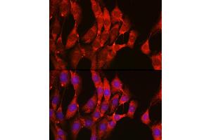Immunofluorescence analysis of C6 cells using NRAS Rabbit pAb (ABIN7267532) at dilution of 1:100 (40x lens).