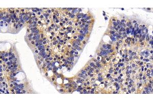 Detection of Surv in Human Small intestine Tissue using Monoclonal Antibody to Survivin (Surv) (Survivin anticorps  (AA 1-142))