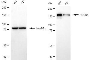 Western blotting analysis using ROCK1 antibody (ABIN7800201). (Recombinant ROCK1 anticorps)