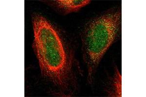 Immunofluorescent staining of human cell line U-2 OS shows positivity in nucleus & cytoplasm. (Plexin A1 anticorps)