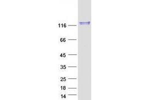 Validation with Western Blot