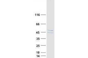Validation with Western Blot